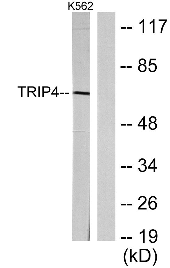 ASC-1 Rabbit Polyclonal Antibody
