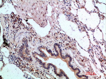 ASCL1 Rabbit Polyclonal Antibody