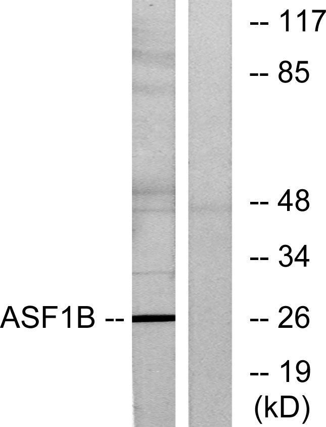 ASF1B Rabbit Polyclonal Antibody