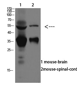 ASIC1 Rabbit Polyclonal Antibody