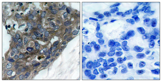 ASK 1 Rabbit Polyclonal Antibody