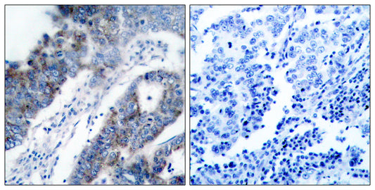 ASK 1 Rabbit Polyclonal Antibody