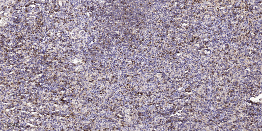 ASPM Rabbit Polyclonal Antibody