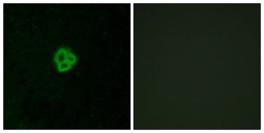 AT1 Rabbit Polyclonal Antibody
