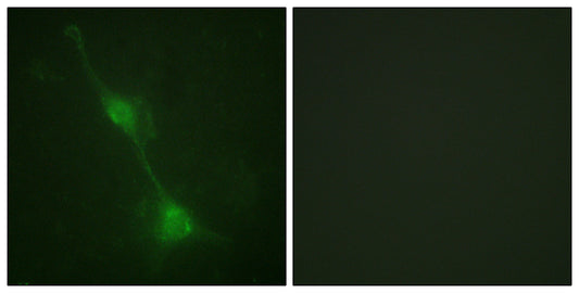 Ataxin-1 Rabbit Polyclonal Antibody