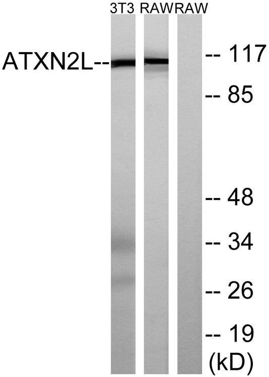 Ataxin-2L Rabbit Polyclonal Antibody