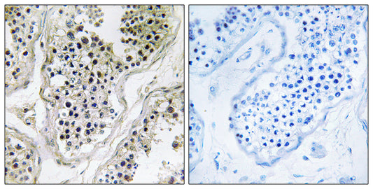 Ataxin-7L1 Rabbit Polyclonal Antibody