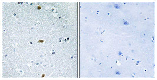 ATBF1 Rabbit Polyclonal Antibody