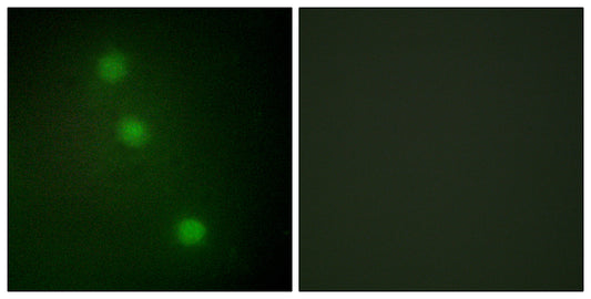ATF-1 Rabbit Polyclonal Antibody