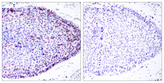 ATF-2 Rabbit Polyclonal Antibody
