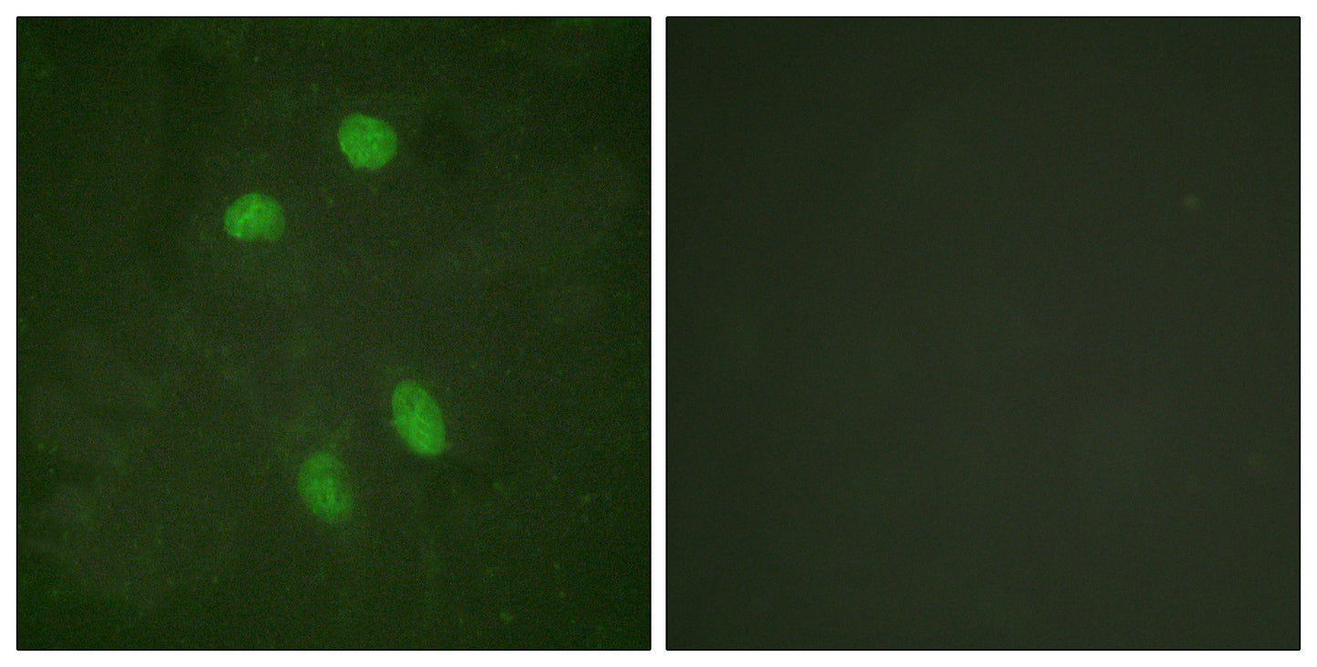 ATF-2 Rabbit Polyclonal Antibody