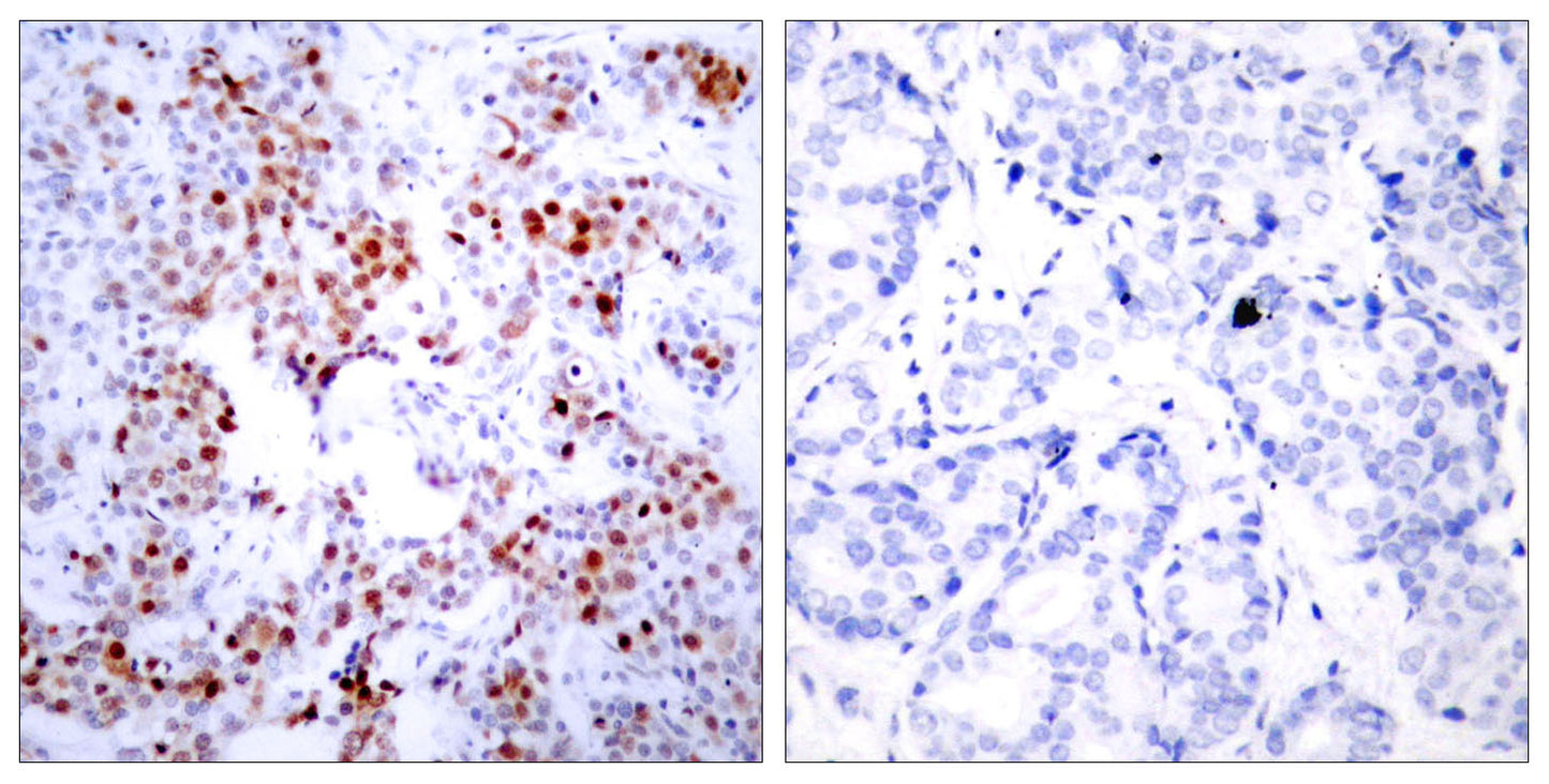 ATF-2 Rabbit Polyclonal Antibody