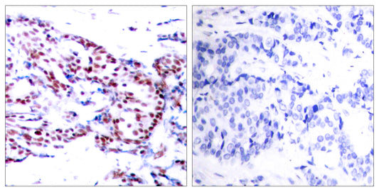 ATF-2 Rabbit Polyclonal Antibody