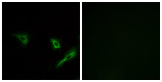 Atg4A Rabbit Polyclonal Antibody