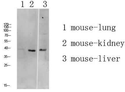 ATG4A Rabbit Polyclonal Antibody