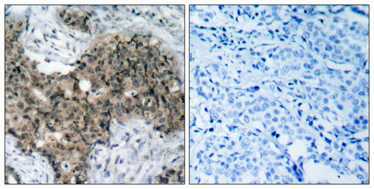 Atm Rabbit Polyclonal Antibody