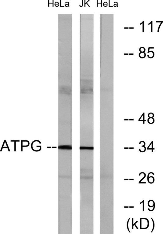 ATP5C1 Rabbit Polyclonal Antibody