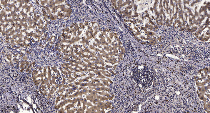 ATP5G1 Rabbit Polyclonal Antibody