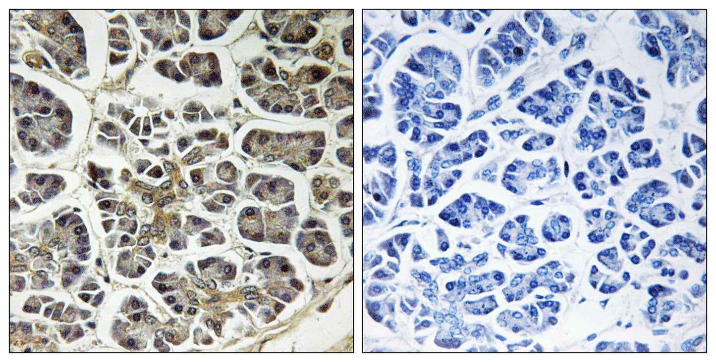 ATP5G2 Rabbit Polyclonal Antibody