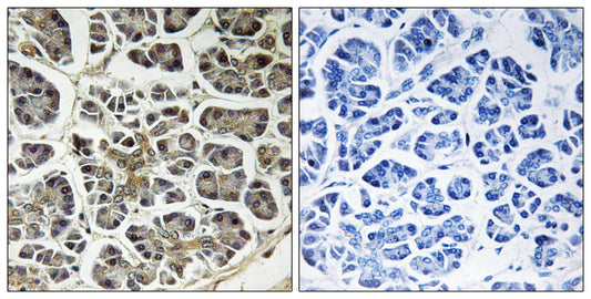 ATP5G2 Rabbit Polyclonal Antibody