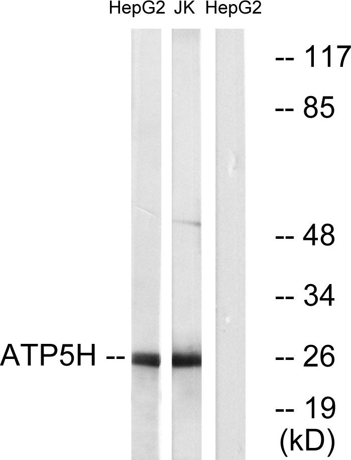 ATP5H Rabbit Polyclonal Antibody