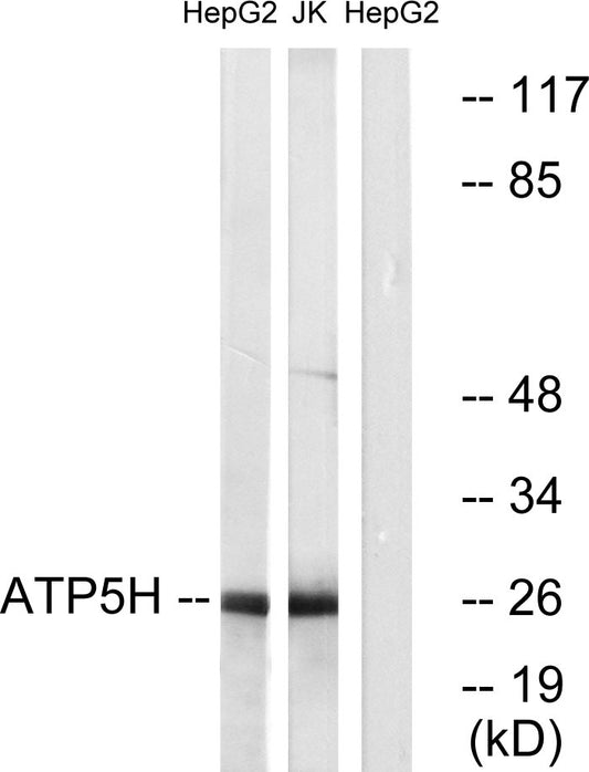 ATP5H Rabbit Polyclonal Antibody