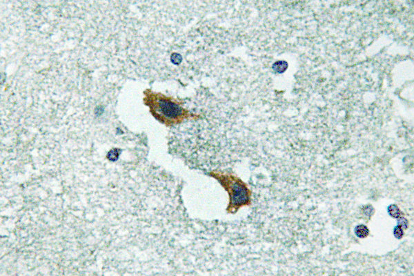 ATP7A Rabbit Polyclonal Antibody