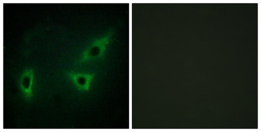 ATP7B Rabbit Polyclonal Antibody