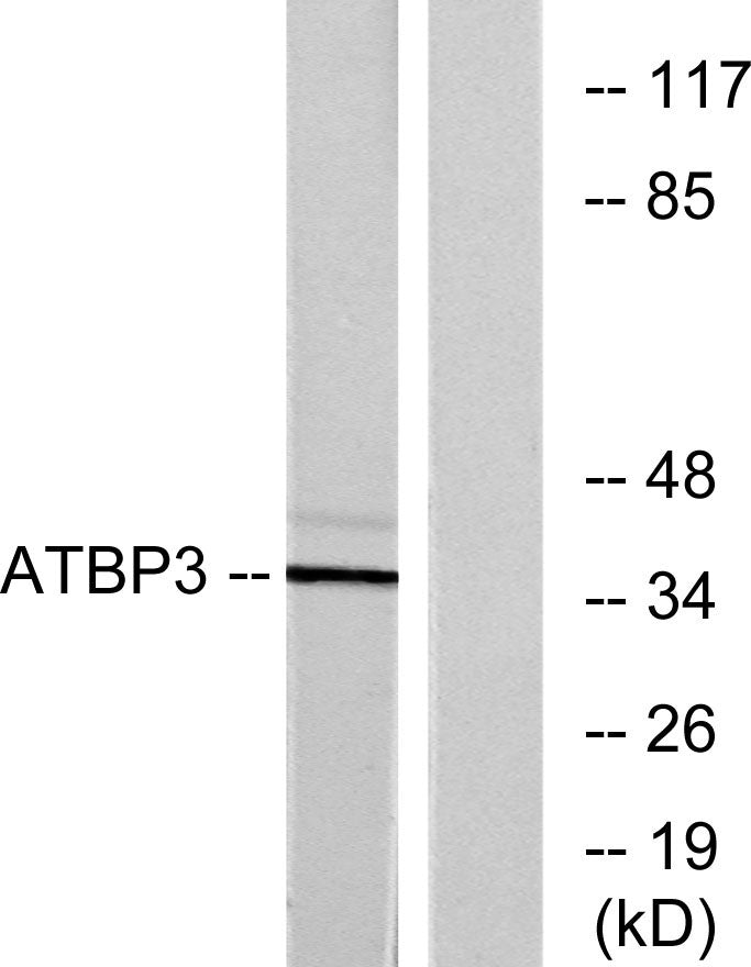 ATPBD3 Rabbit Polyclonal Antibody