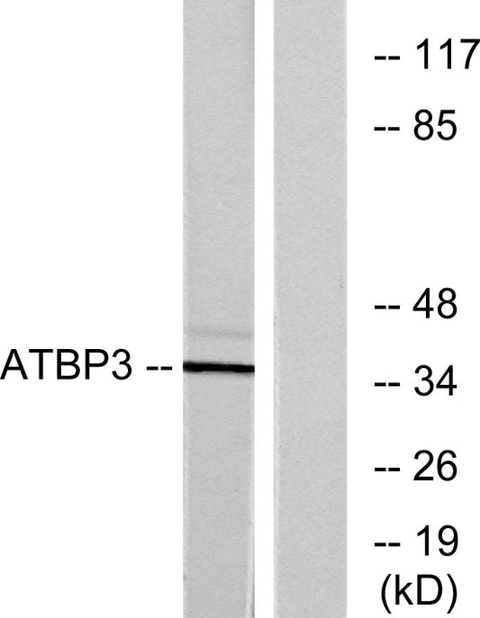 ATPBD3 Rabbit Polyclonal Antibody