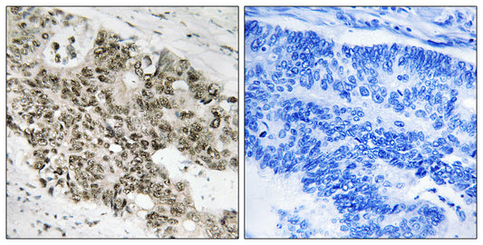 ATR Rabbit Polyclonal Antibody
