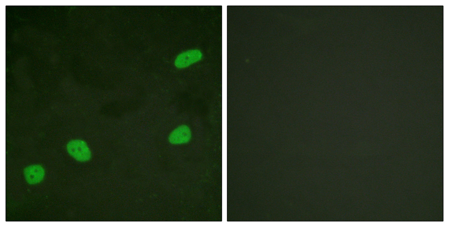 ATRIP Rabbit Polyclonal Antibody