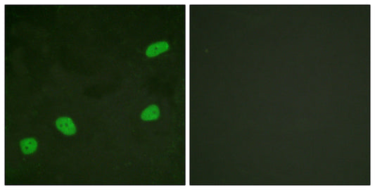 ATRIP Rabbit Polyclonal Antibody