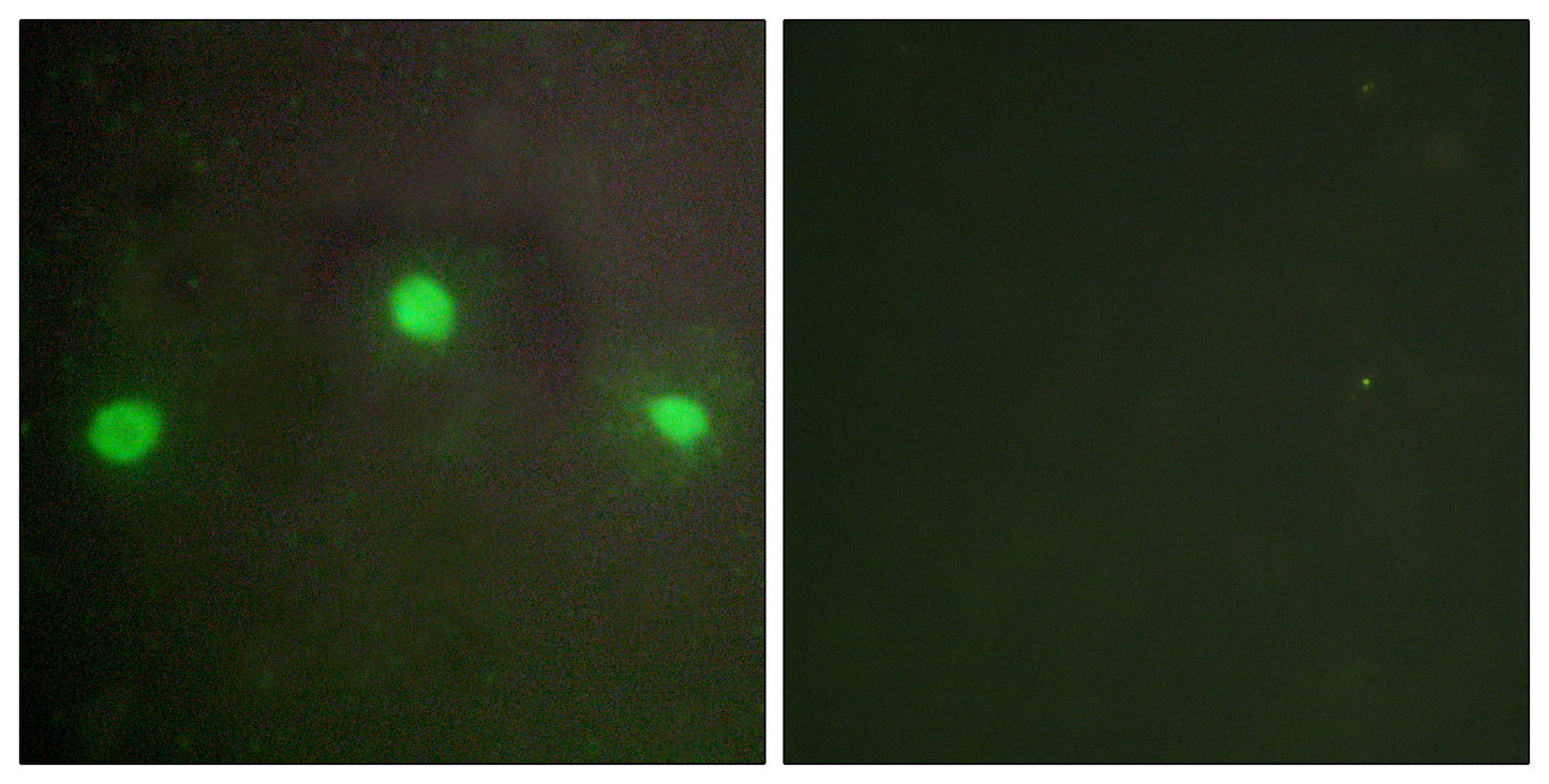 ATRX Rabbit Polyclonal Antibody