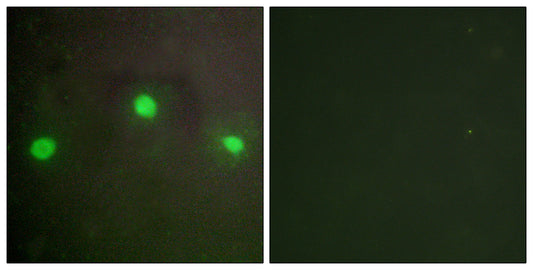 ATRX Rabbit Polyclonal Antibody