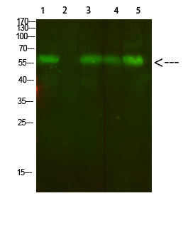 AVP Receptor V2 Rabbit Polyclonal Antibody