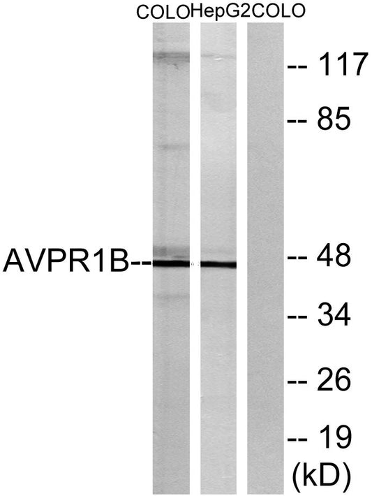 AVP Receptor V3 Rabbit Polyclonal Antibody