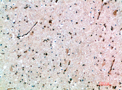 AVP Receptor V3 Rabbit Polyclonal Antibody