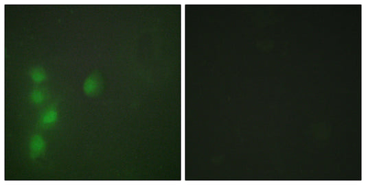 AW-1 Rabbit Polyclonal Antibody