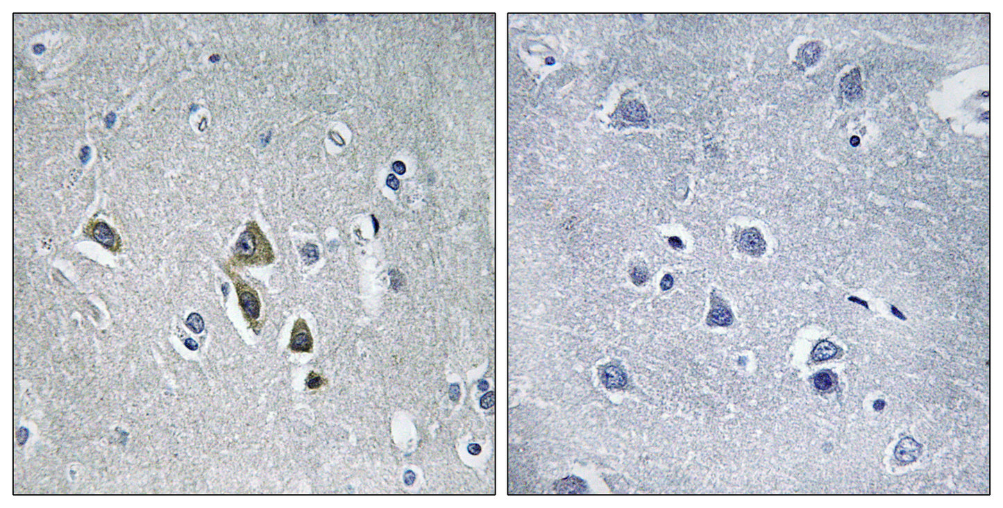 AZ1 Rabbit Polyclonal Antibody