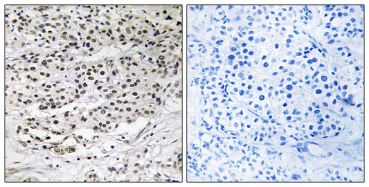 AZI1 Rabbit Polyclonal Antibody