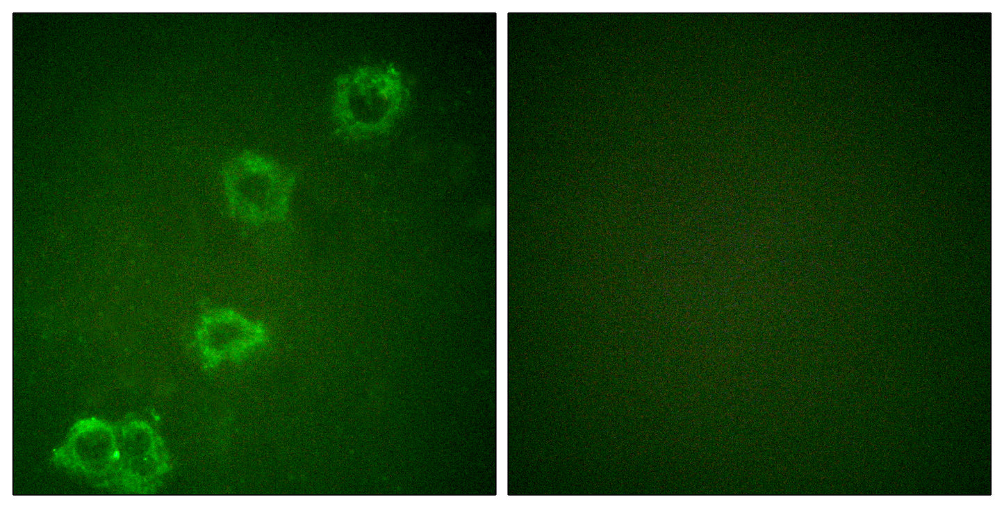 BACE Rabbit Polyclonal Antibody