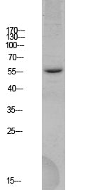BACE Rabbit Polyclonal Antibody