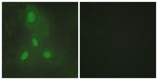 BACH1 Rabbit Polyclonal Antibody