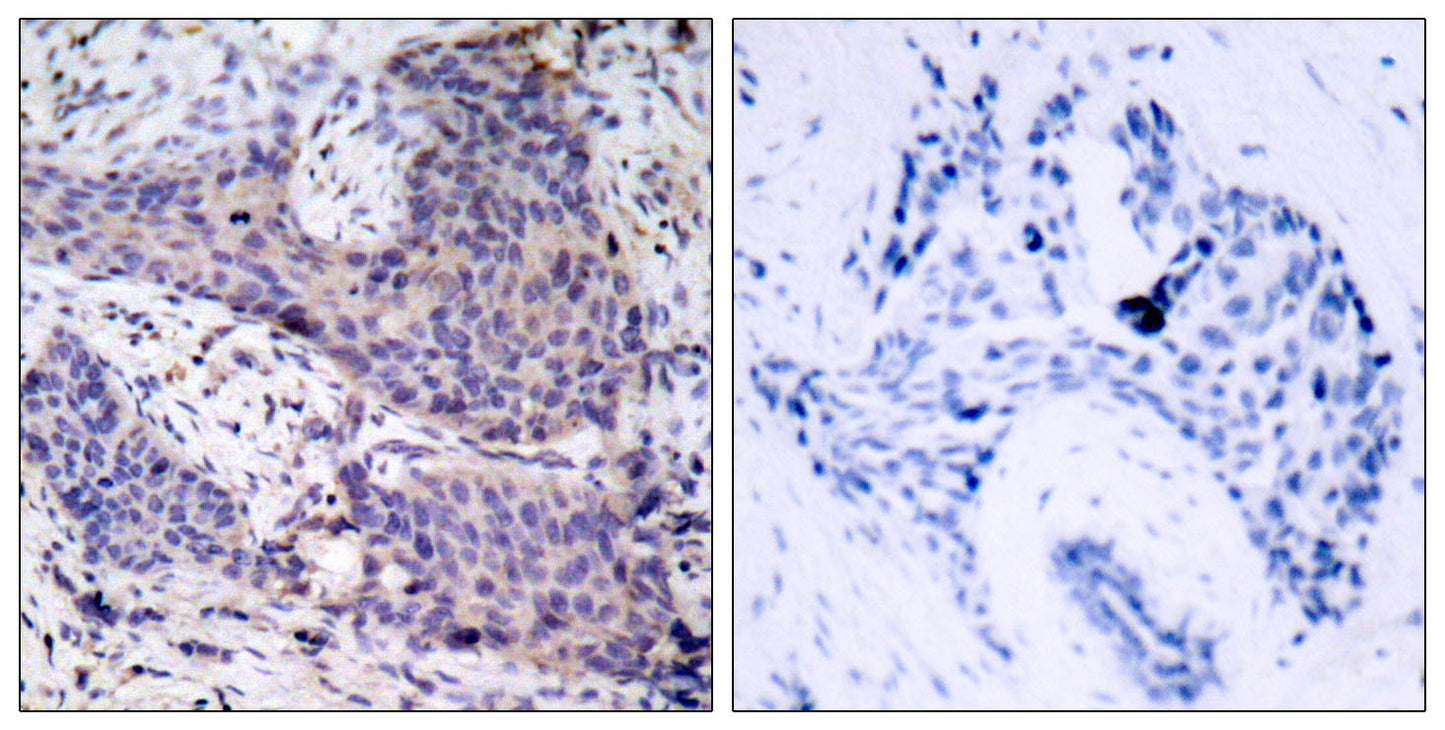 Bad Rabbit Polyclonal Antibody