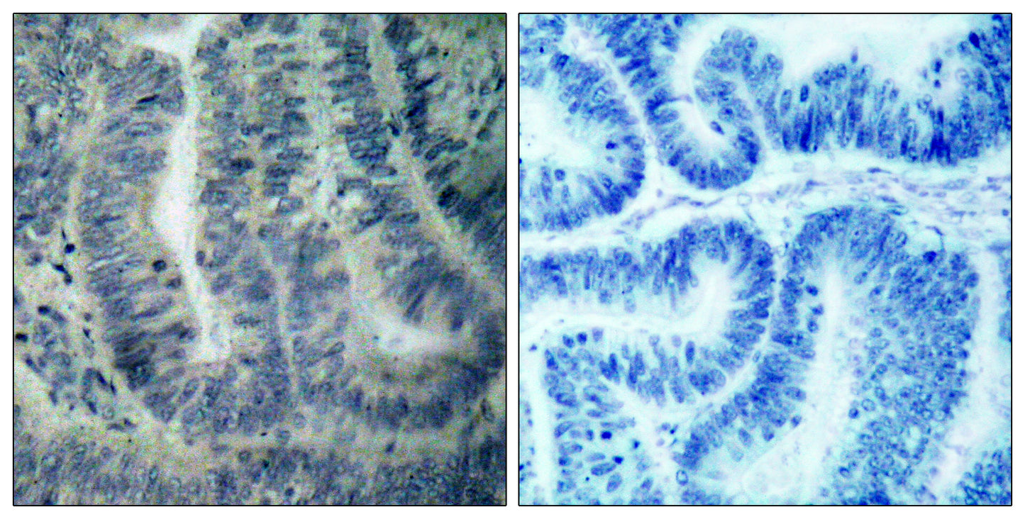 Bad Rabbit Polyclonal Antibody