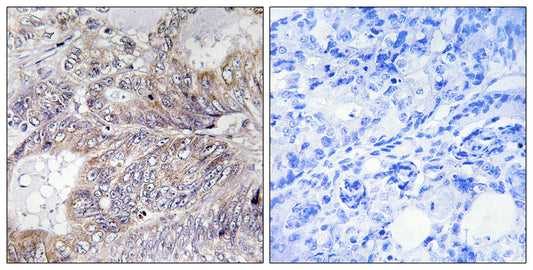 Bad Rabbit Polyclonal Antibody