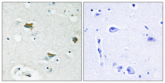 Bad Rabbit Polyclonal Antibody