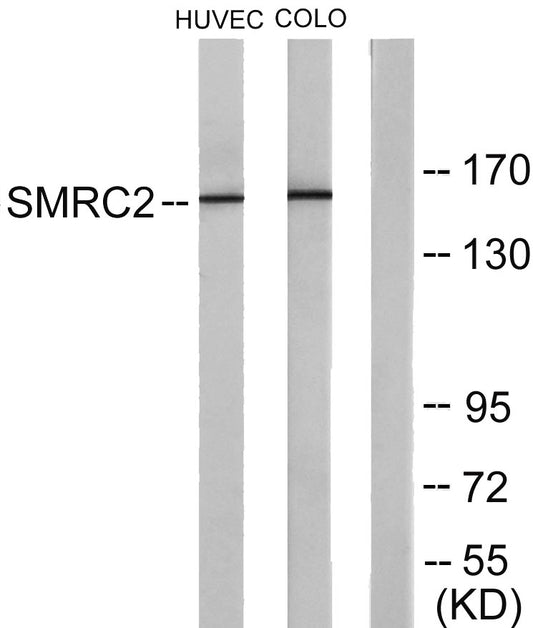BAF170 Rabbit Polyclonal Antibody