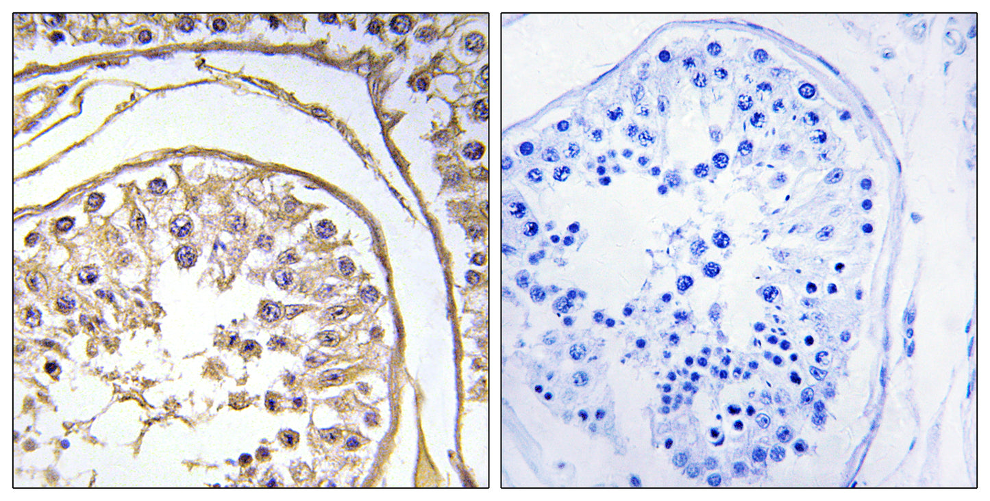 BAGE2 Rabbit Polyclonal Antibody
